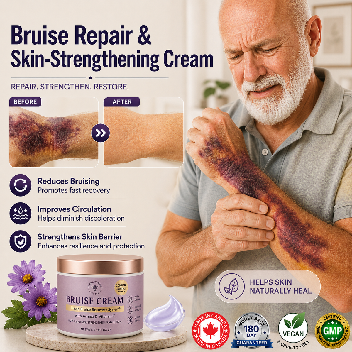 💥New Upgraded Version - Bruise Cream to repair bruises and strengthen the skin