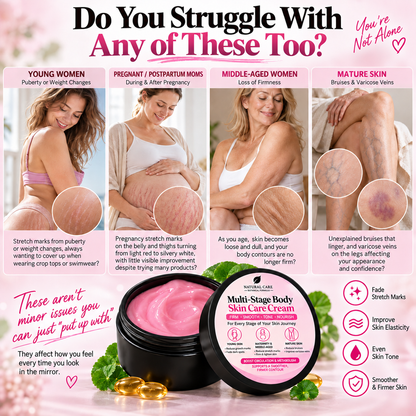 🔥Multi-Stage Body Skin Care Cream - Eliminates Spots & Stretch Marks, Firms Skin, Fades Bruises, and Boosts Metabolism & Fat Burning.